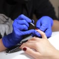 Achieve Perfect, Smooth Nails For Stunning Designs With FDA-Approved Microneedling